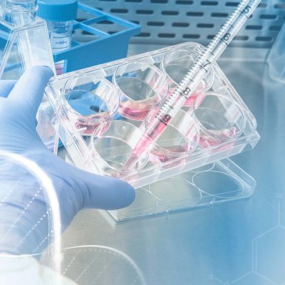 The New World of RNA Extraction